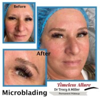 Microblading Before and After Procedure