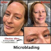 Microbladed Brows Before And After