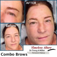 Before and After Combo Brows Procedure
