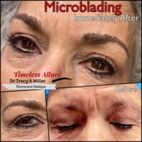 Microbladed brows before and after
