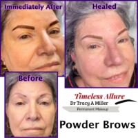 Powder Brows Before, After, and Healed